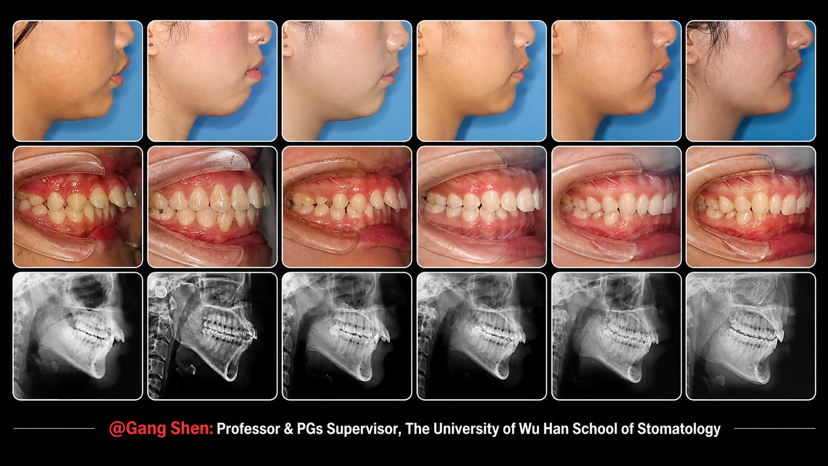 Slide 5 Classifications